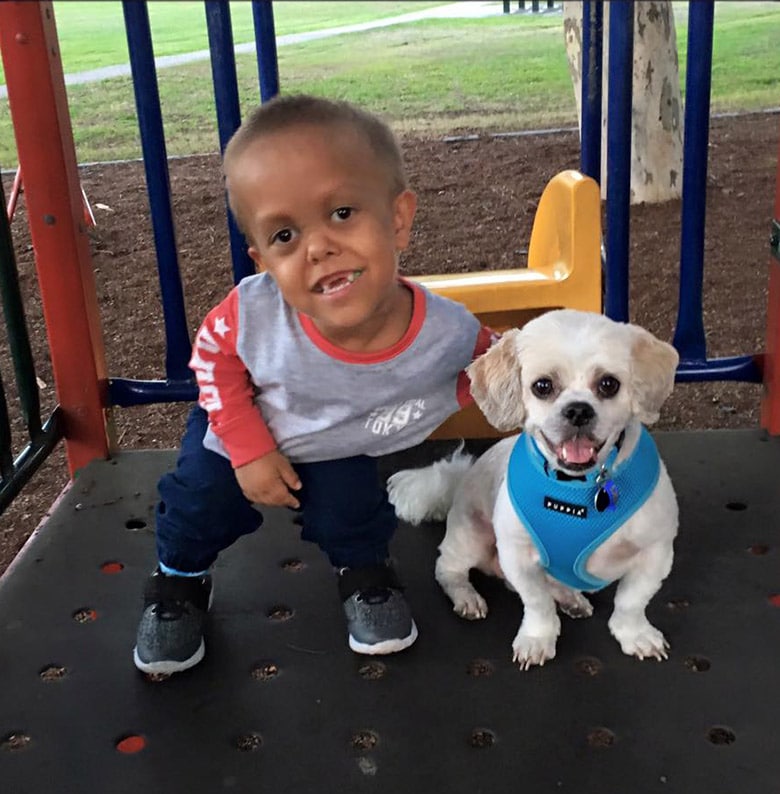 Boy Born With Dwarfism Finds Friend in Dog With Same Condition