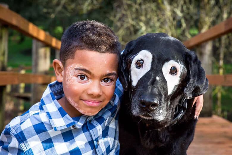 Boy and Dog With Same Skin Condition Finally Get to Meet
